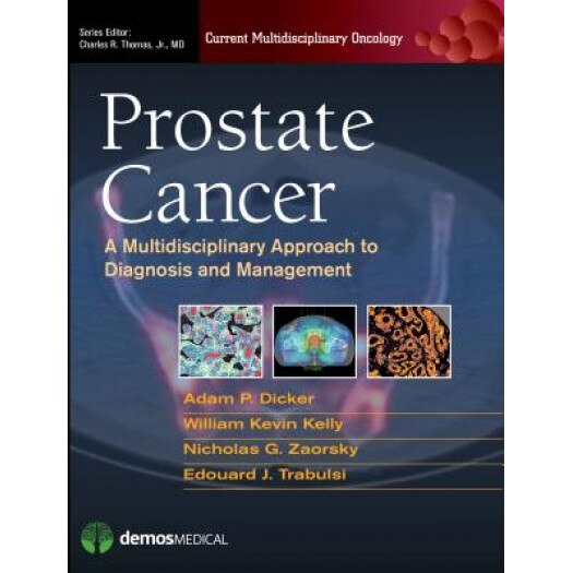 Prostate Cancer: A Multidisciplinary Approach to Diagnosis and Management, Wm Kevin Kelly (Editor)