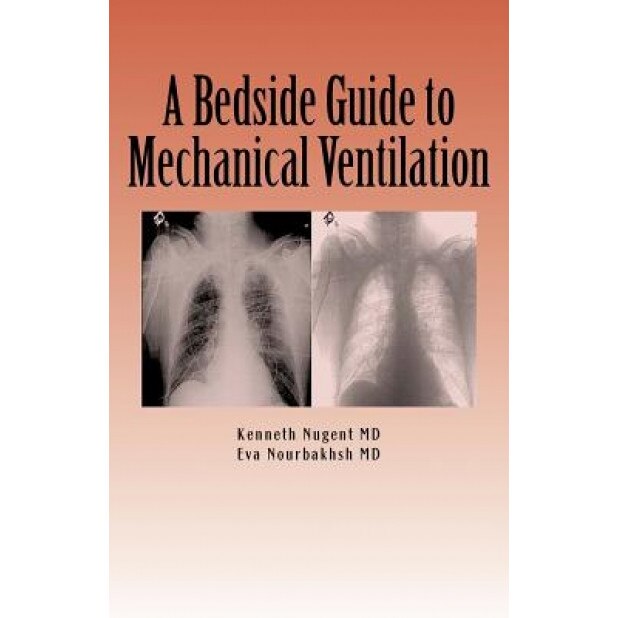 A Bedside Guide to Mechanical Ventilation, Bsn Jessamy Anderson Rn (Contribution by)