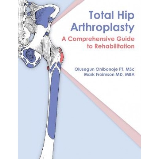 Total Hip Arthroplasty: A Comprehensive Guide to Rehabilitation - Olusegun Onibonoje (Author)