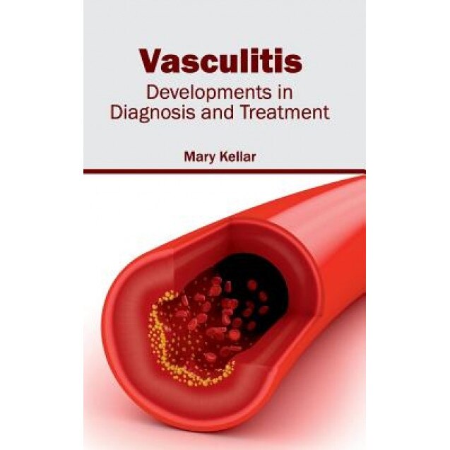 Vasculitis: Developments in Diagnosis and Treatment - Mary Kellar (Editor)