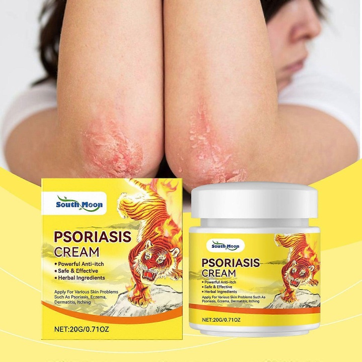 Psoriasis és Ekcéma Krém, 2 darab, Természetes Kivonatokkal, Hidratáló és Nyugtató, 50ml