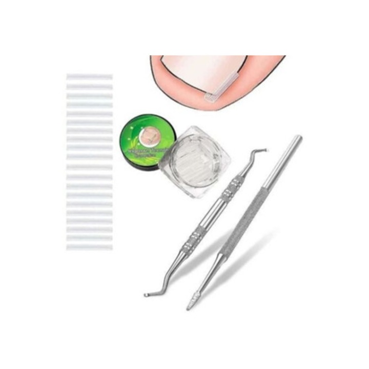 Kit 502 benzi pentru corectarea unghiilor incarnate, accesorii incluse
