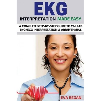 EKG: EKG Interpretation Made Easy: A Complete Step-By-Step Guide to 12-Lead EKG/ECG Interpretation & Arrhythmias, Eva Regan (Author) EKG: EKG Interpretation Made Easy: A Complete Step-By-Step Guide to 12-Lead EKG/ECG Interpretation & Arrhythmias, Eva Regan (Author)