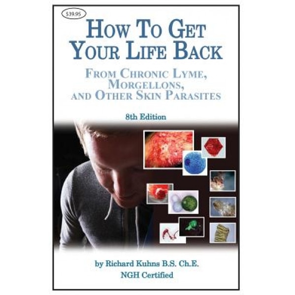 How to Get Your Life Back from Morgellons and Other Skin Parasites Limited Edit, MR Richard L. Kuhns (Author)