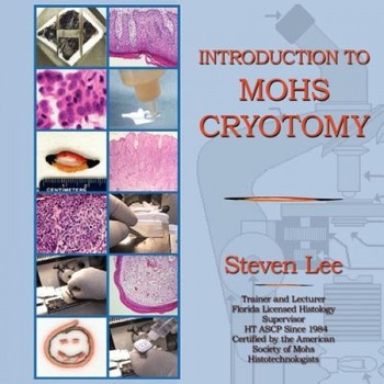 Introduction to Mohs Cryotomy - Steven Lee (Author) Introduction to Mohs Cryotomy - Steven Lee (Author)