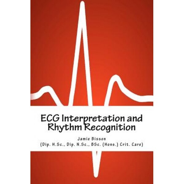 ECG Interpretation and Rhythm Recognition - Jamie Bisson (Author)