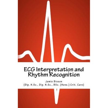 ECG Interpretation and Rhythm Recognition - Jamie Bisson (Author) ECG Interpretation and Rhythm Recognition - Jamie Bisson (Author)