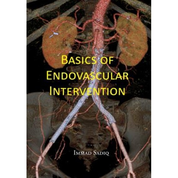 Basics of Endovascular Intervention, Immad R. Sadiq MD (Author)