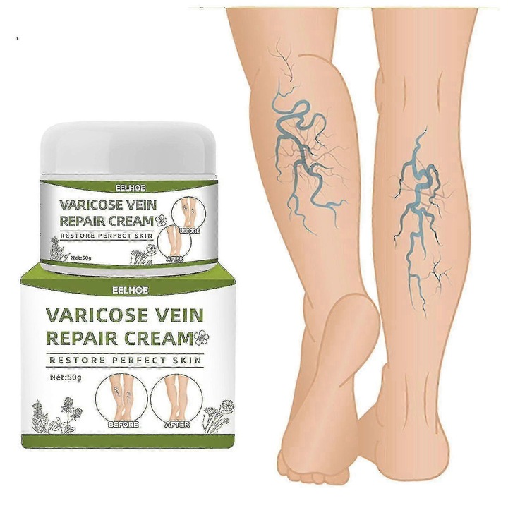 Krém visszérre 50g, csökkenti a visszerek megjelenését, javítja a vérkeringést, minden bőrtípusra