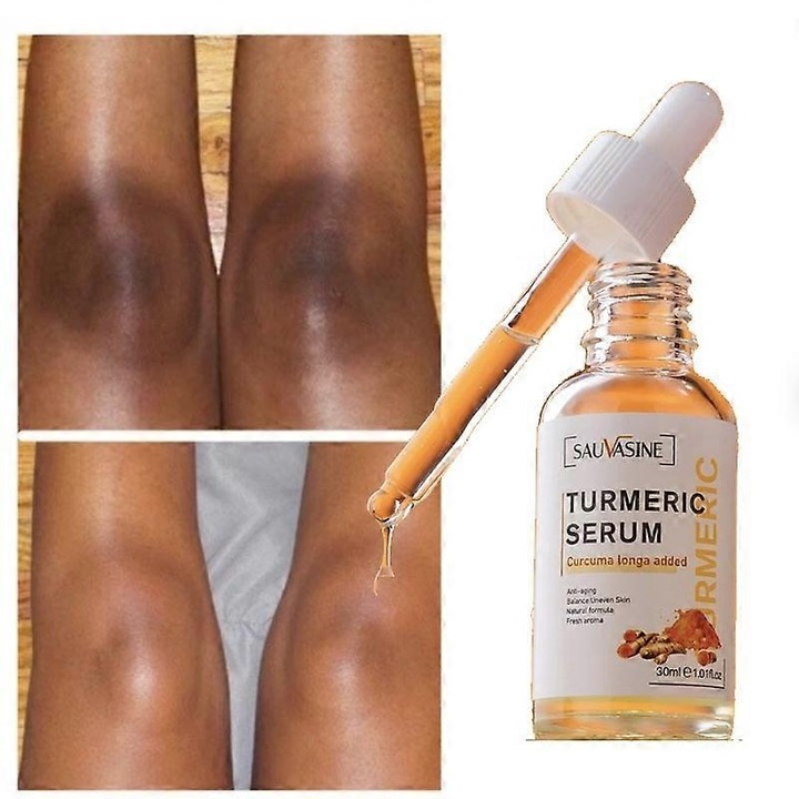 Serum corector pentru pete intunecate cu turmeric si ulei de lamaie, 30 ml