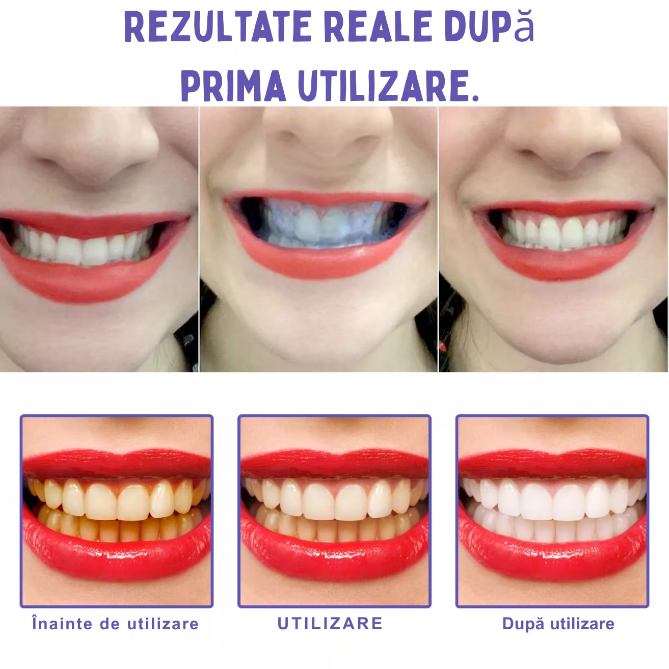 PACHET COMPLET ALBIRE DINTI - Benzi Albire dinti + pasta mov cadou - imagine 8