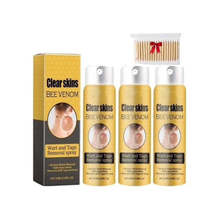 3 darab méhméreg spray szemölcsökre, szemölcskezelés