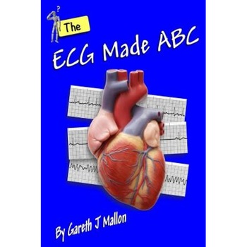 The ECG Made ABC, Gareth J. Mallon (Author) The ECG Made ABC, Gareth J. Mallon (Author)