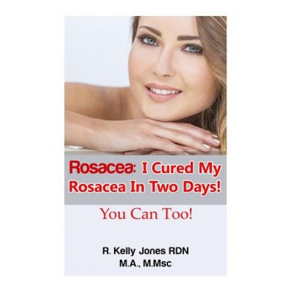 Rosacea: I Cured My Rosacea in Two Days! You Can Too!, R. Kelly Jones (Author)