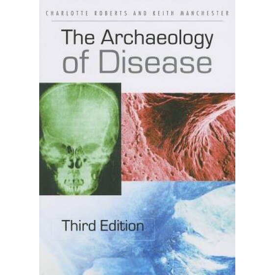 The Archaeology of Disease - Charlotte Roberts (Author)