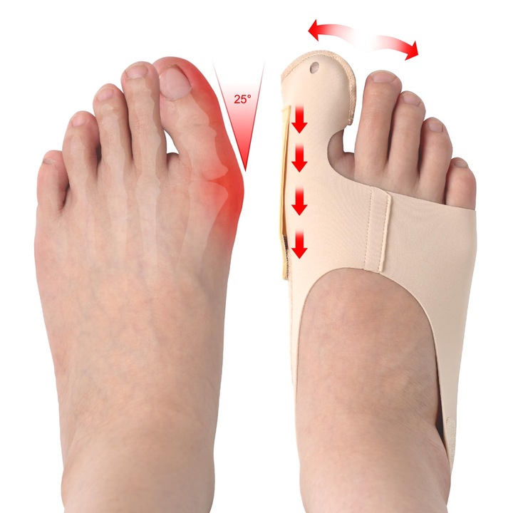 Set suporturi ortopedice pentru hallux valgus, 2 piese, ajustabile, pentru stanga si dreapta, marime mare, confortabile, pentru zi si noapte