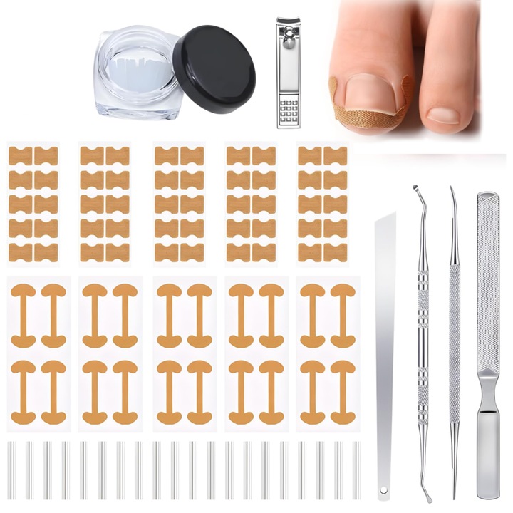Kit de corectare a unghiilor incarnate cu 139 de piese, plasture respirabil pentru unghii, tampoane C pentru corectarea unghiilor de la picioare, set profesional de instrumente de manichiura pentru ameliorarea durerii, ingrijirea unghiilor