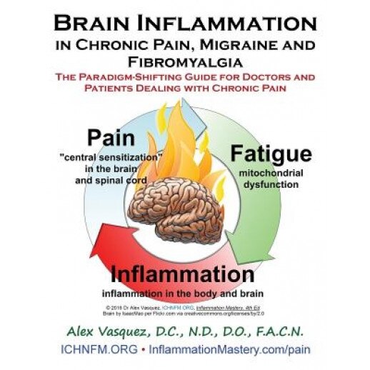 Brain Inflammation in Chronic Pain, Migraine and Fibromyalgia: The Paradigm-Shifting Guide for Doctors and Patients Dealing with Chronic Pain, Alex Vasquez (Author)