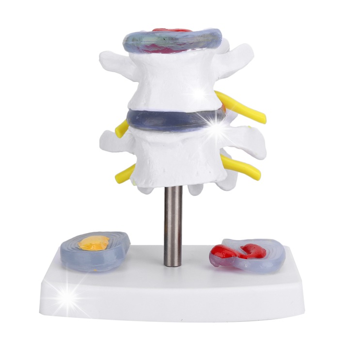 Model anatomic al herniei discului lombar, 2 discuri intervertebrale, 1 baza, PVC, multicolor