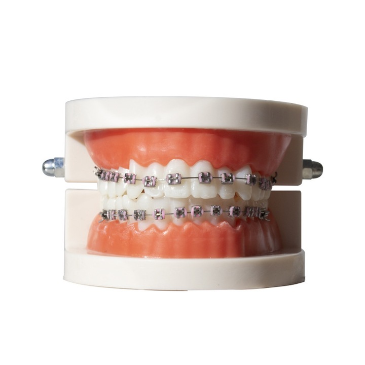 Model demonstrativ din metal pentru bracket-uri dentare, baza roz, comunicare pacient clinic
