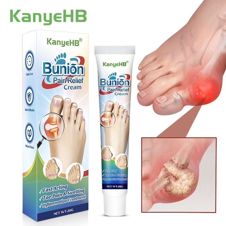 Bütyökkrém, 20g, lábápolás, külsőleges használatra