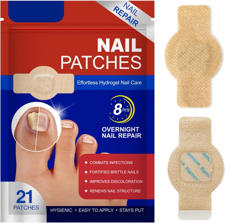 Комплект от 21 противогъбични пластира за увредени нокти – Ефективно нощно лечение, buc®, Против инфекции, Бързо възстановяване, Лесен за нанасяне