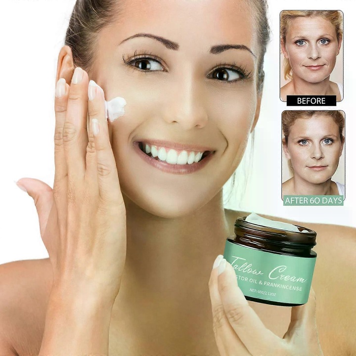 Marhaperzsír balzsam tömjénolajjal és ricinusolajjal, 3 darabos készlet, mélyhidratálás, minden bőrtípusra, 60g