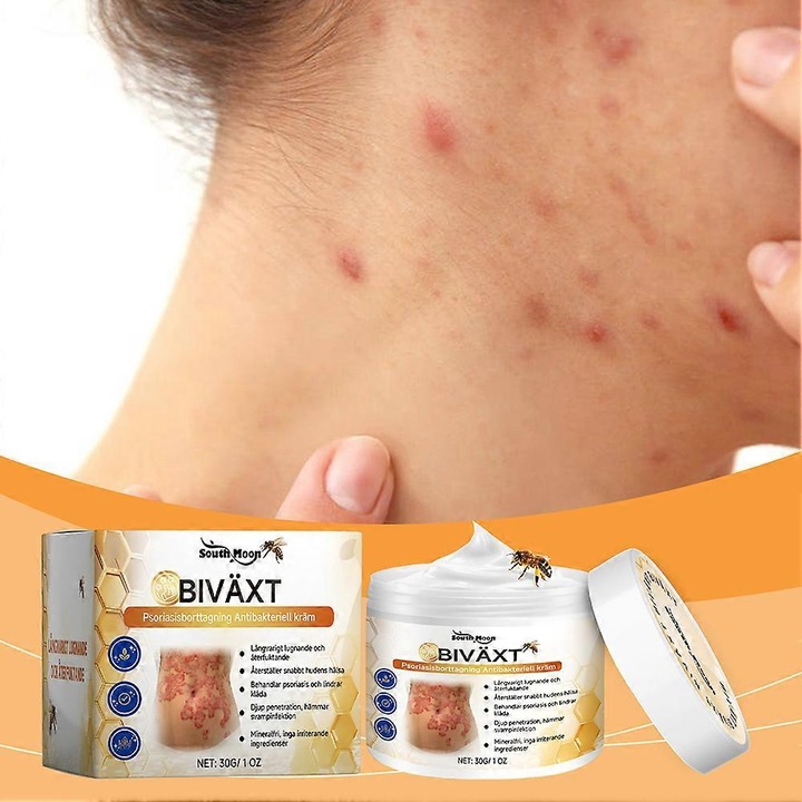 Pszoriázis krém méhméreggel, 30g, 5.2x3.8cm, 1 db-os készlet