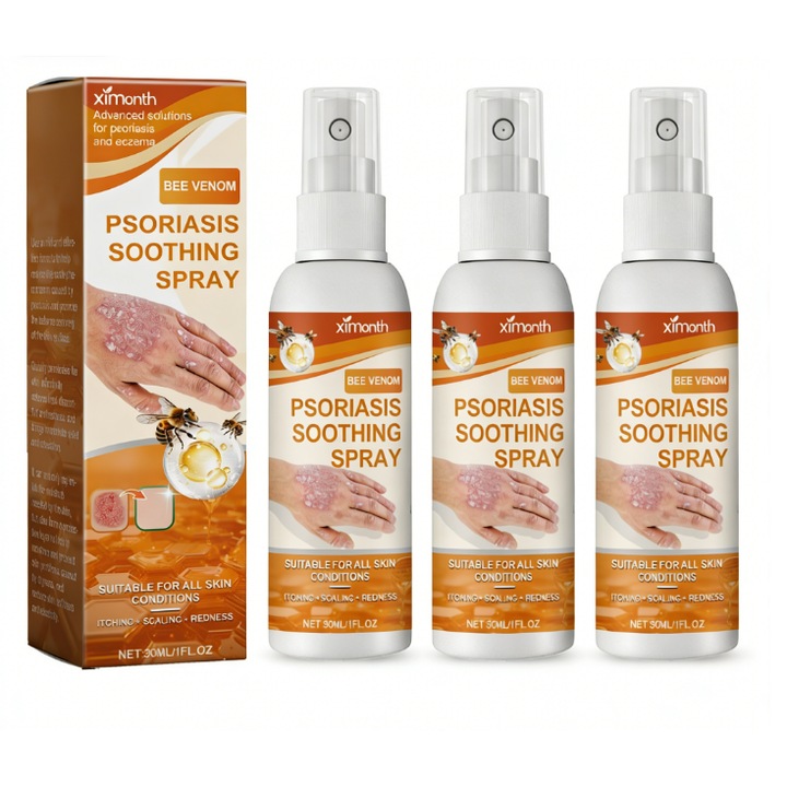 Pikkelysömör elleni krém, 3 darab, gyengéd formula, csökkenti a viszketést, 150ml