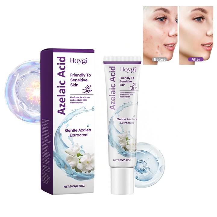 Crema facială Hoygi, 12% acid azelaic, 20ml, uniformizare nuanță, hidratare pentru toate tipurile de piele