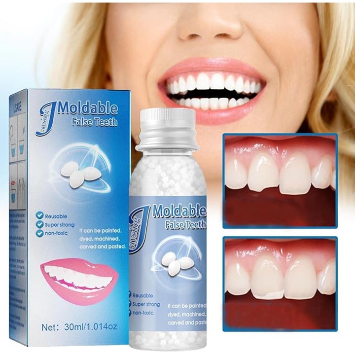 A TrioStore® fogjavító készlet praktikus megoldást kínál ideiglenes fogászati ​​javításra, otthoni, előre nem látható helyzetekben történő ideiglenes használatra. A termék alkalmas ideiglenes rögzítésre anélkül, hogy helyettesítené a fogorvosi konzultáció