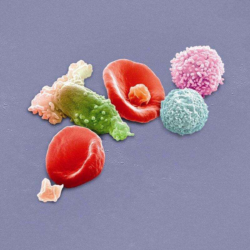 Peter Gabriel (from Genesis)-New Blood Live In London ( Deluxe Edition)-BD+DVD+2CD