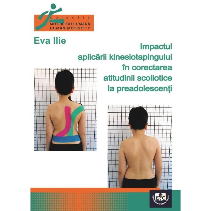 Impactul aplicarii kinesiotapingului in corectarea atitudinii scoliotice la preadolescenti, Eva Ilie, 2022