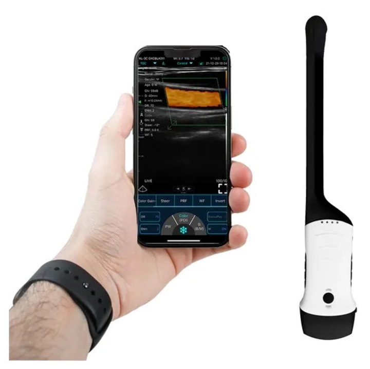 Ecograf portabil wireless 2 in 1 cu sonda convexa si transvaginala, Golden Protect