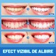 Ленти Binovation® за избелване на зъби Premium Whitening Strips, професионална технология, бързо и равномерно избелване, премахване на петна, естествена бяла усмивка, комплект 28 броя