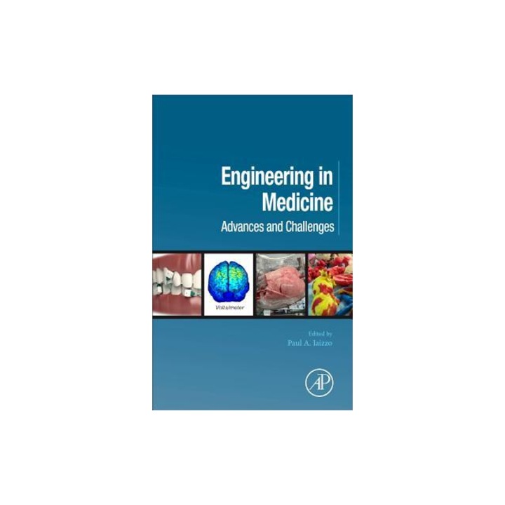 Engineering in Medicine: Advances and Challenges, Paul A. Iaizzo (Editor)