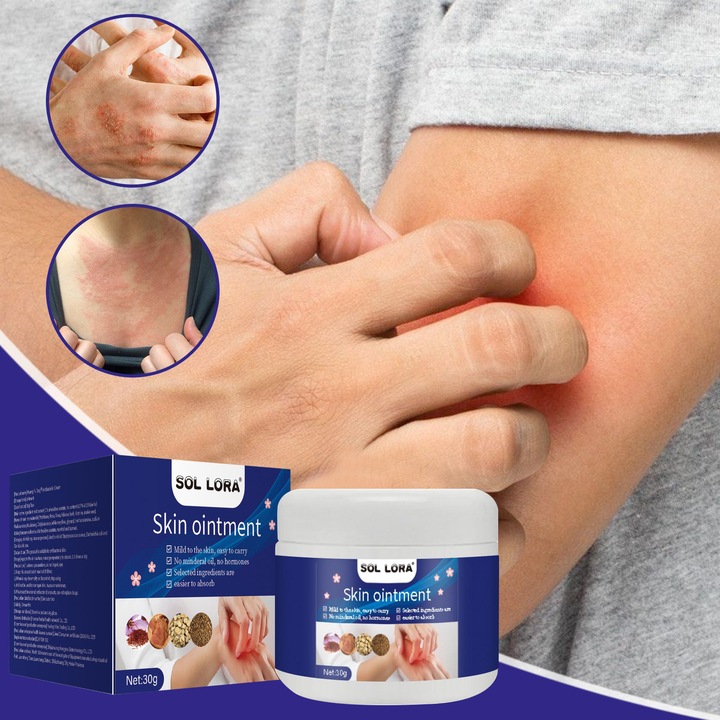 Kenőcs bőrviszketésre és rovarcsípésekre, Viola yedoensis-szel, 30ml