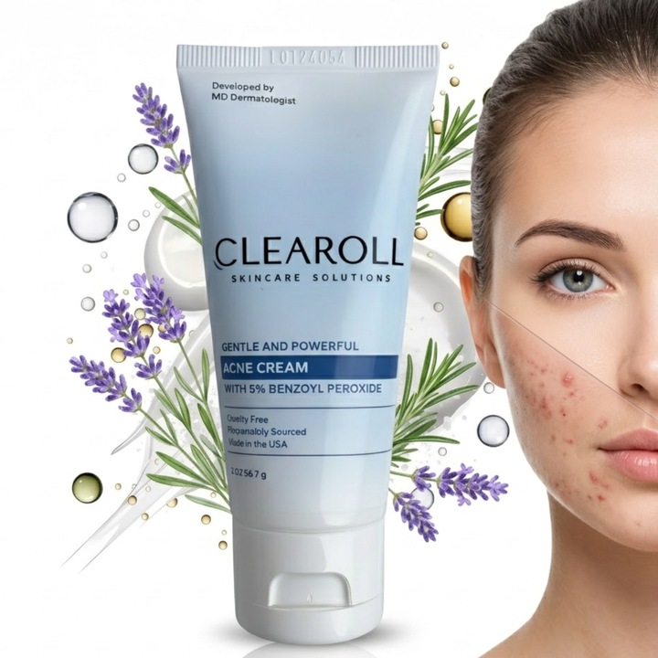 Crema acnee Clearoll®, crema de zi, tratament anti-acnee, pori dilatati, puncte negre, potrivita pentru ten sensibil, testata dermatologic, fabricata in SUA, 56.7 g