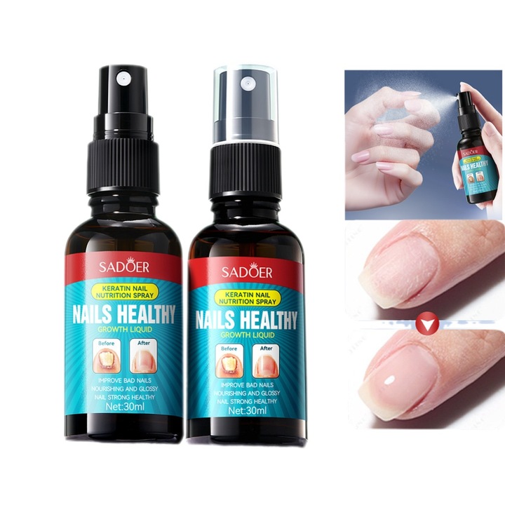 2 db SADOER Körömkezelő Spray Keratinnal és Teafaolajjal, Erősítő, Hidratáló és Javító Hatás Törékeny, Vékony vagy Sérült Körmökre, 2 x 30ml