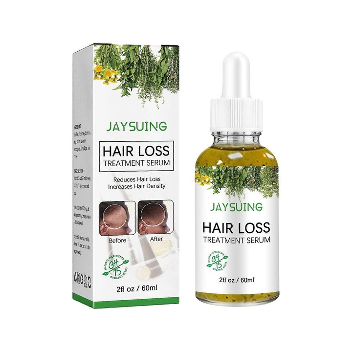 Ser pentru scalp Jaysuing Tratament pentru caderea parului, cu ulei de menta, reduce caderea parului si hraneste radacinile, Galben, 60ml
