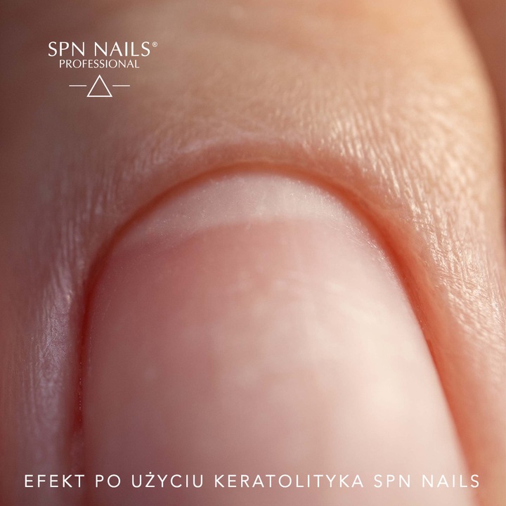 SPN Nails Keratolitikum, körömágybőr kezelés, 15ml