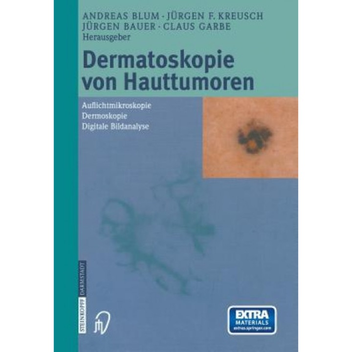 Dermatoskopie Von Hauttumoren: Auflichtmikroskopie Dermoskopie Digitale Bildanalyse, A. Blum (Editor)