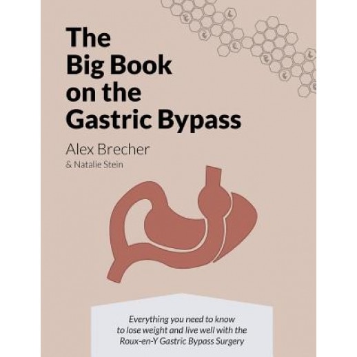 The Big Book on the Gastric Bypass: Everything You Need to Know to Lose Weight and Live Well with the Roux-En-Y Gastric Bypass Surgery - Alex Brecher (Author)