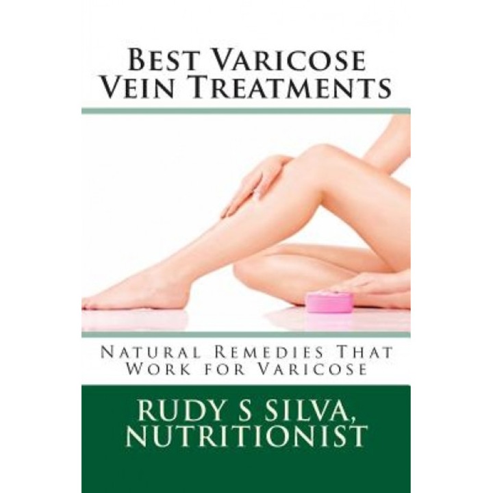 Best Varicose Vein Treatments: Natural Remedies That Work for Varicose, Rudy Silva Silva (Author)