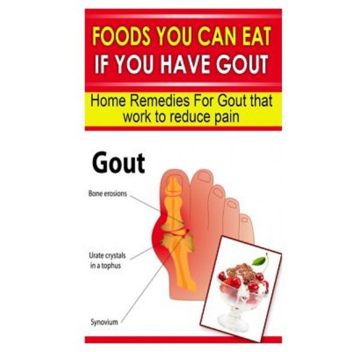 Foods You Can Eat If You Have Gout: Home Remedies for Gout That Work to Reduce Pain - Doc Goodman (Author)