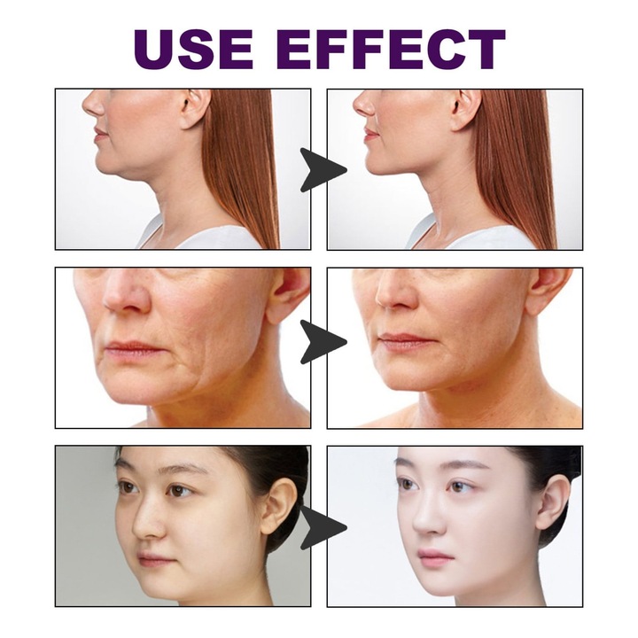 Banda lifting facial invizibila, 120 buc, elastica, 6x8cm