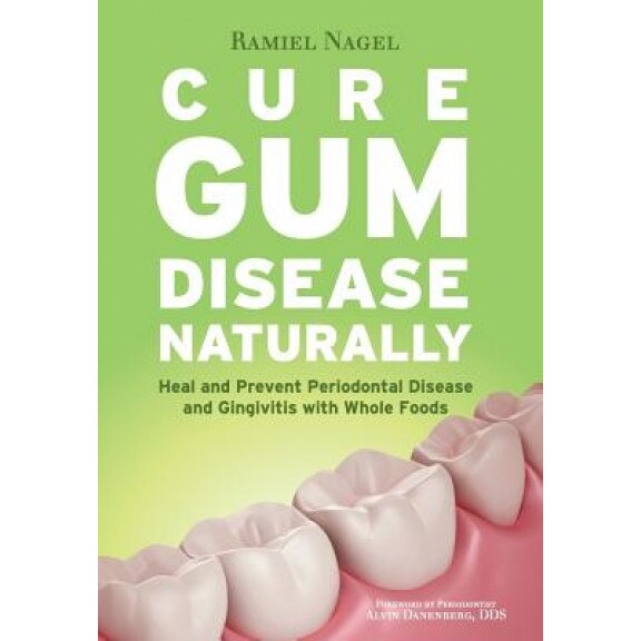 Cure Gum Disease Naturally: Heal Gingivitis and Periodontal Disease with Whole Foods, Ramiel Nagel (Author)