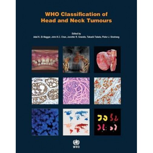 WHO Classification of Head and Neck Tumours - Adel K. El-Naggar (Editor)