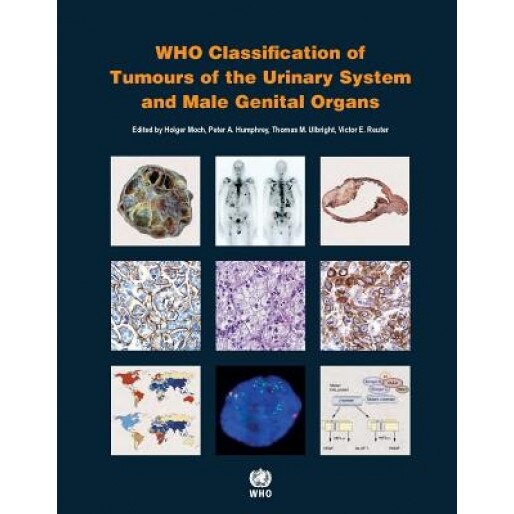 WHO Classification of Tumours of the Urinary System and Male Genital Organs - International Agency for Research on Can (Author)