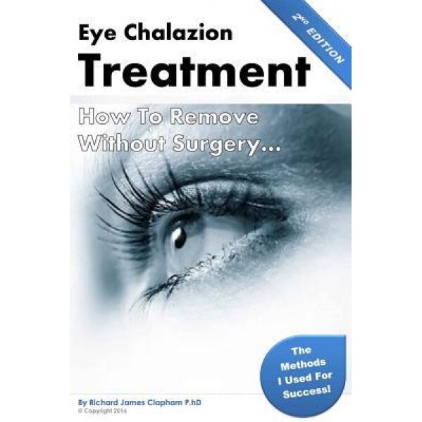 Eye Chalazion: How to Remove Without Surgery: My Personal Experience and the Methods I Used for Success, MR Richard James Clapham Phd (Author)